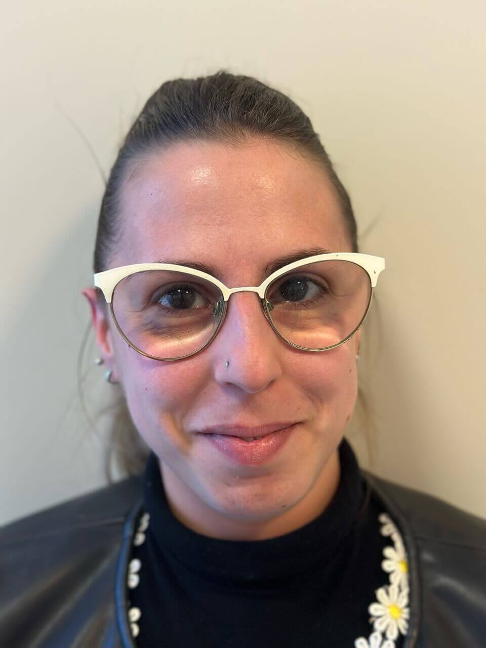 prima facorefrattiva correzione ipermetropia astigmatismo elevati dr. angelo appiotti 1