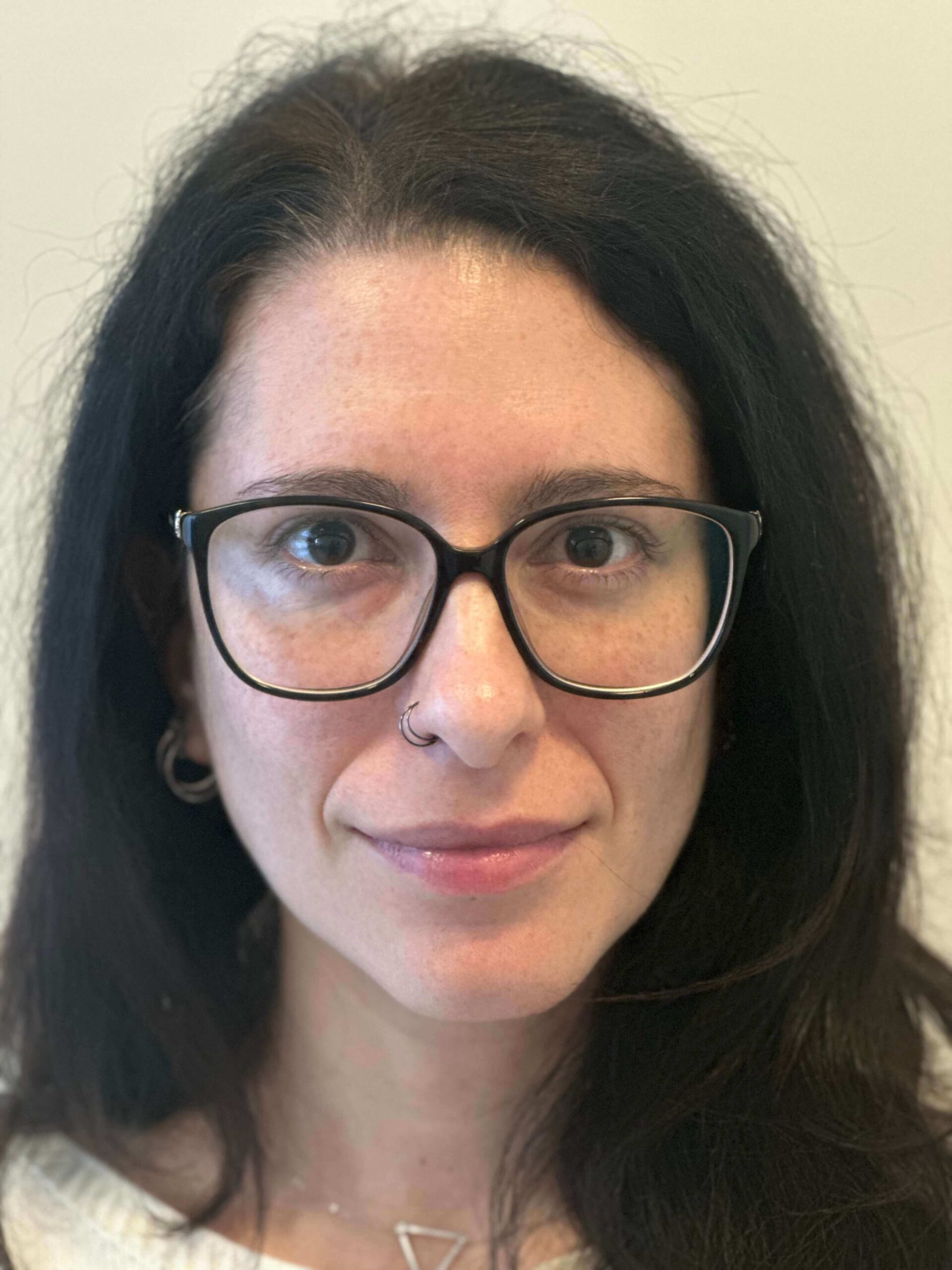 prima femtolasik correzione miopia lieve dr. angelo appiotti scaled