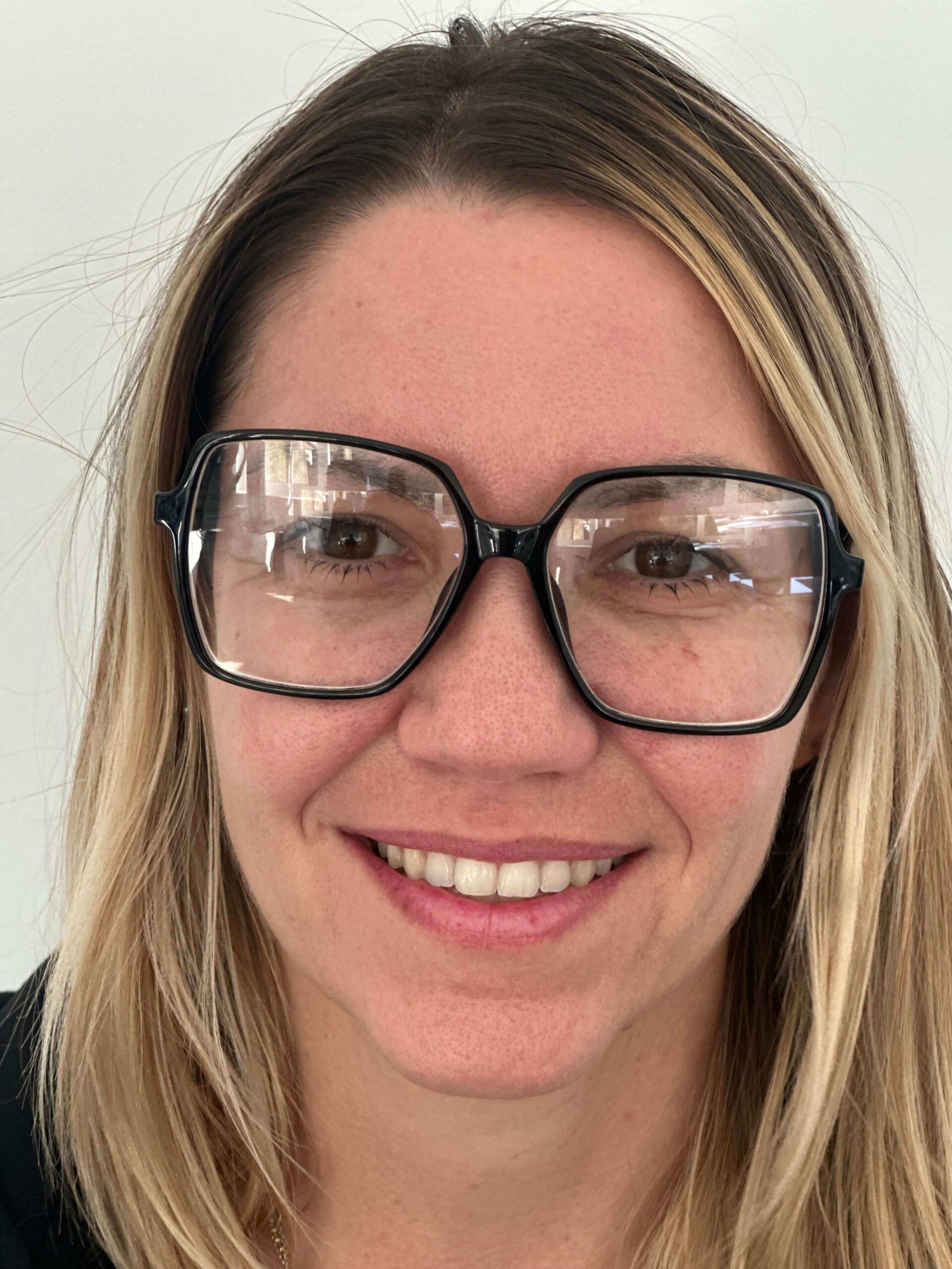 prima femtolasik correzione miopia media astigmatismo lieve dr. angelo appiotti 1 scaled