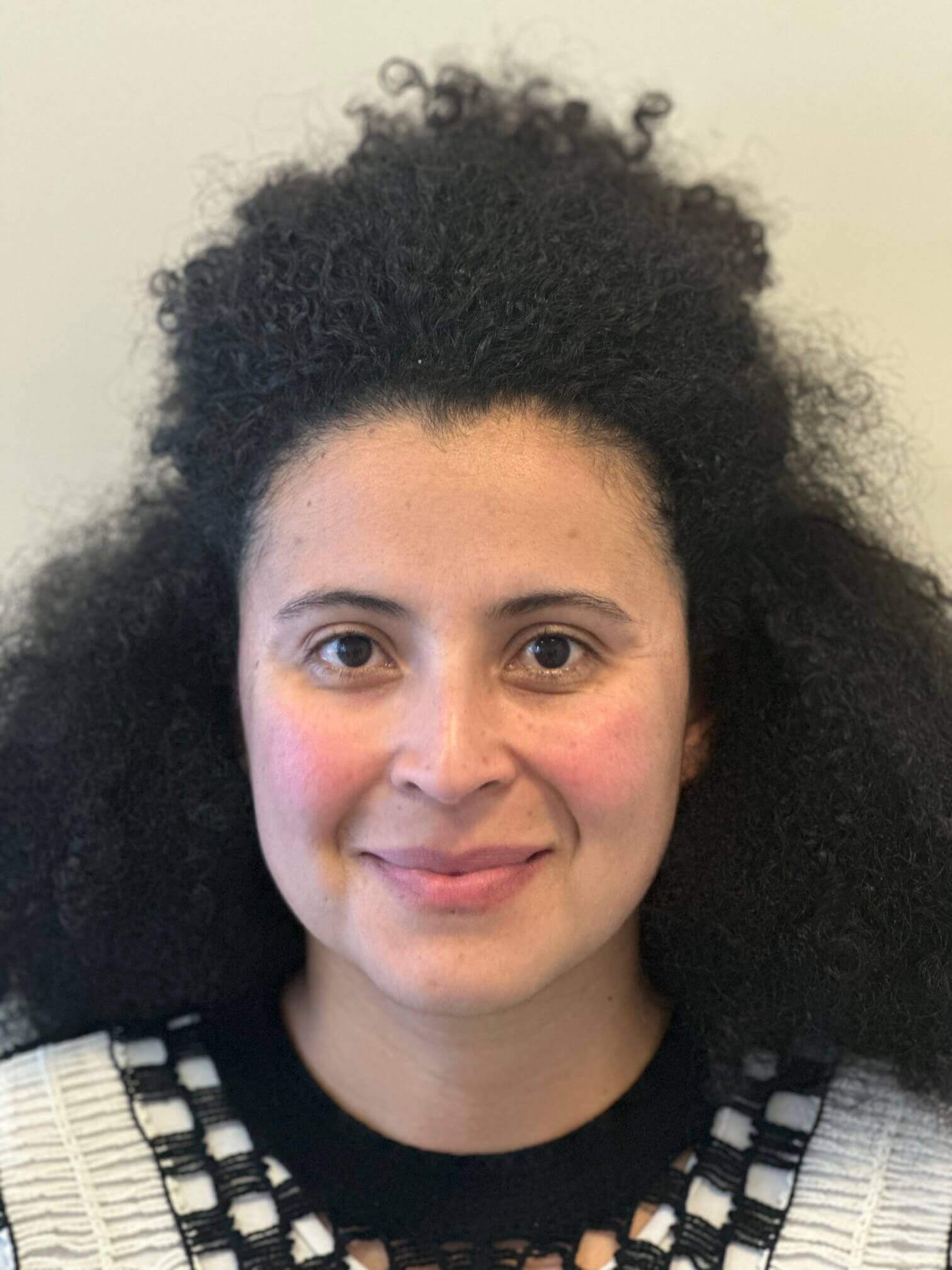 dopo relex smile correzione miopia media con astigmatismo lieve dr. angelo appiotti