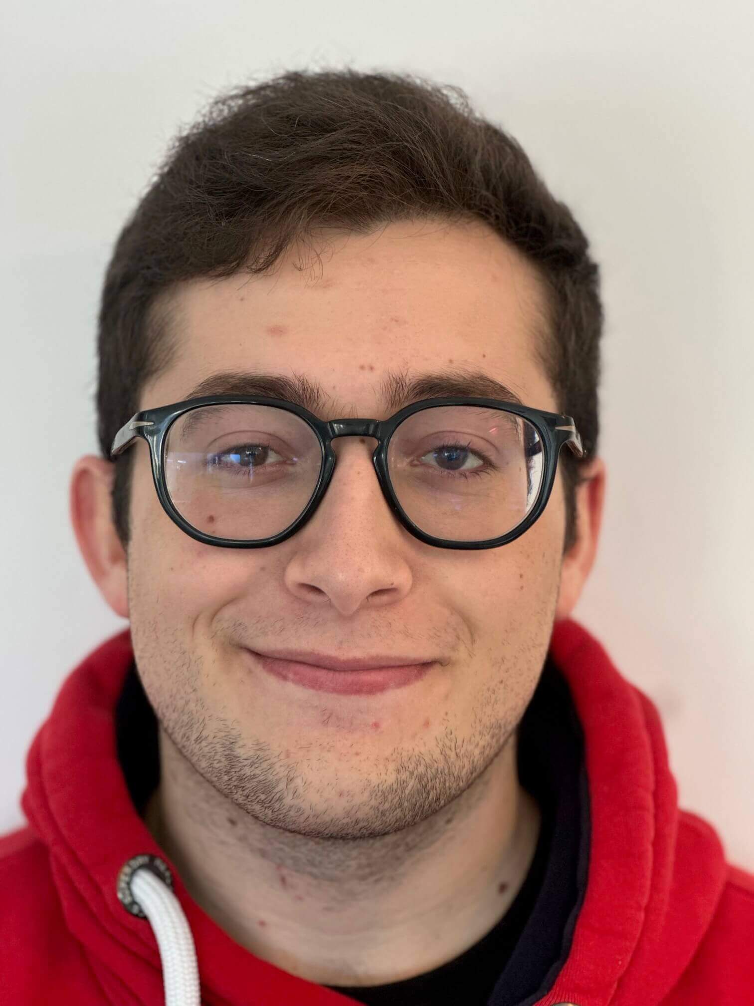 prima icl correzione astigmatismo miopico composto elevato dr. angelo appiotti