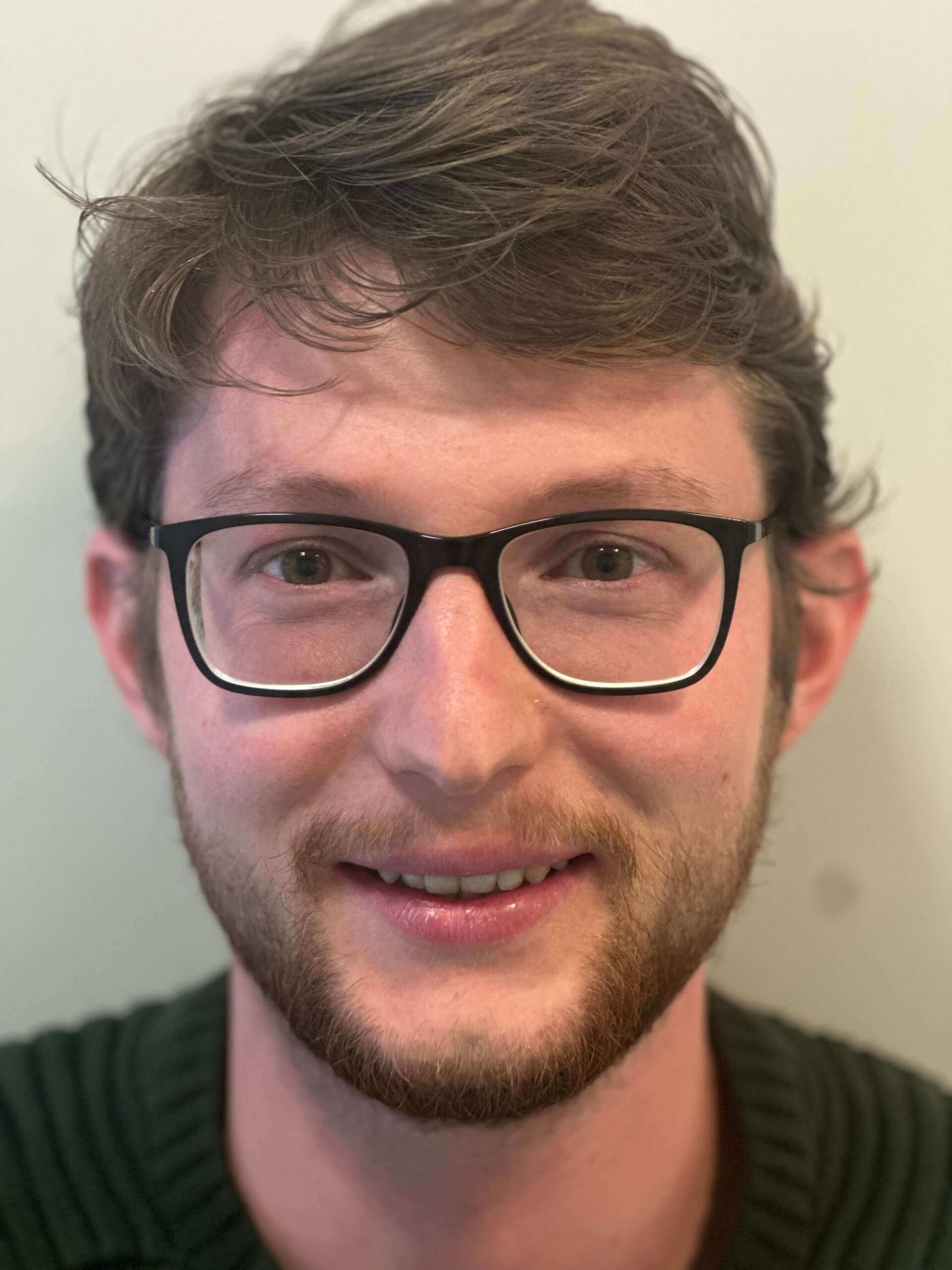 prima icl correzione miopia elevata astigmatismo lieve dr. angelo appiotti scaled