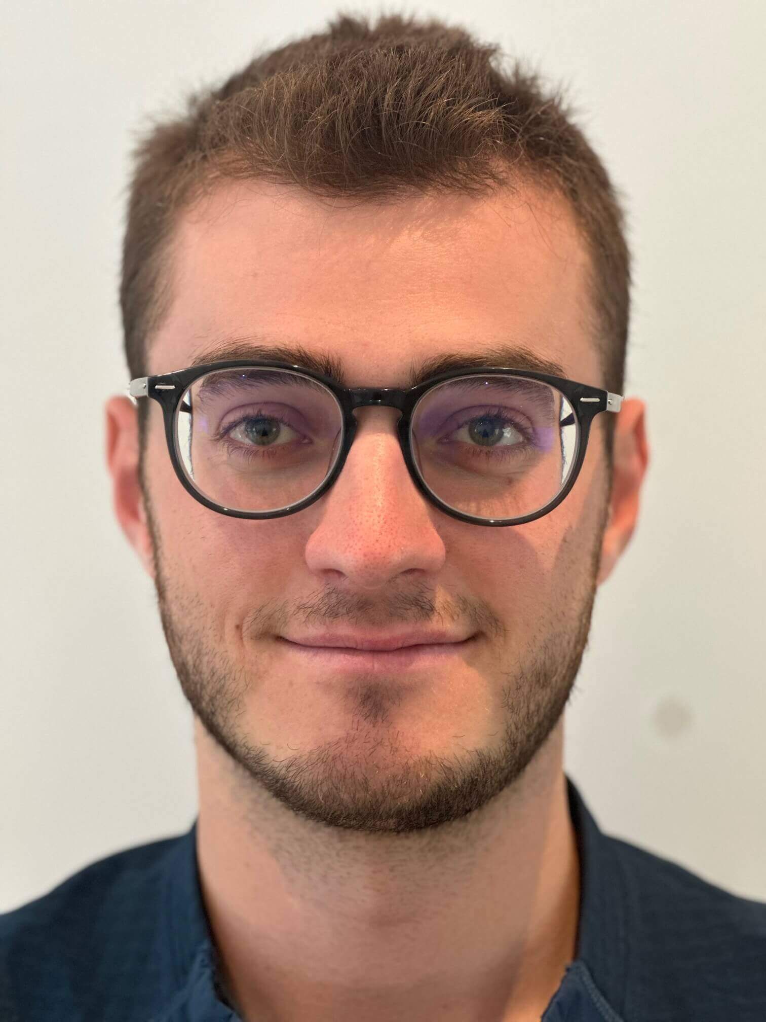 prima icl correzione miopia elevata astigmatismo lieve medio dr. angelo appiotti