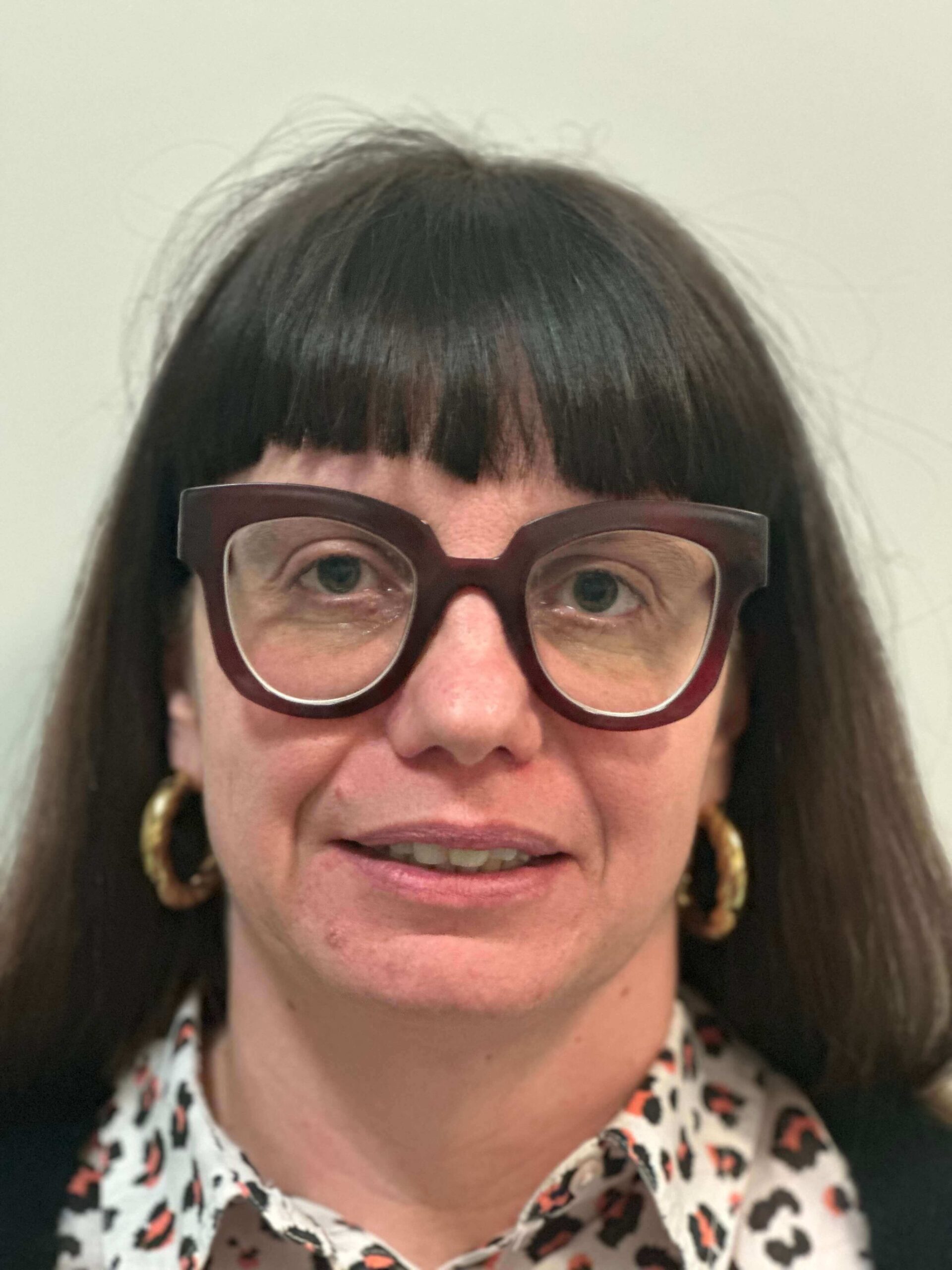 prima prk correzione miopia media elevata astigmatismo medio dr. angelo appiotti scaled