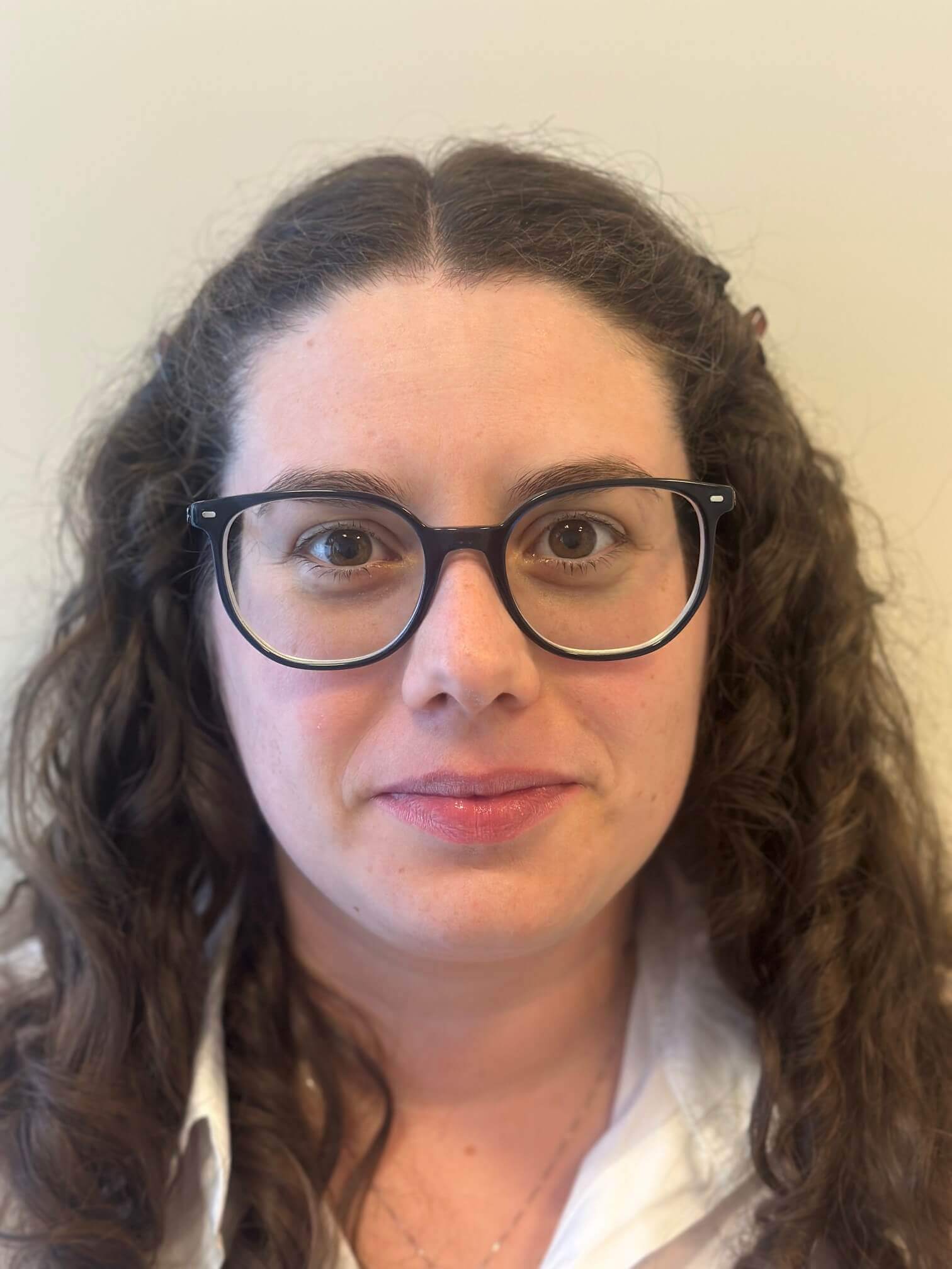 prima relex smile correzione miopia astigmatismo medi dr. angelo appiotti