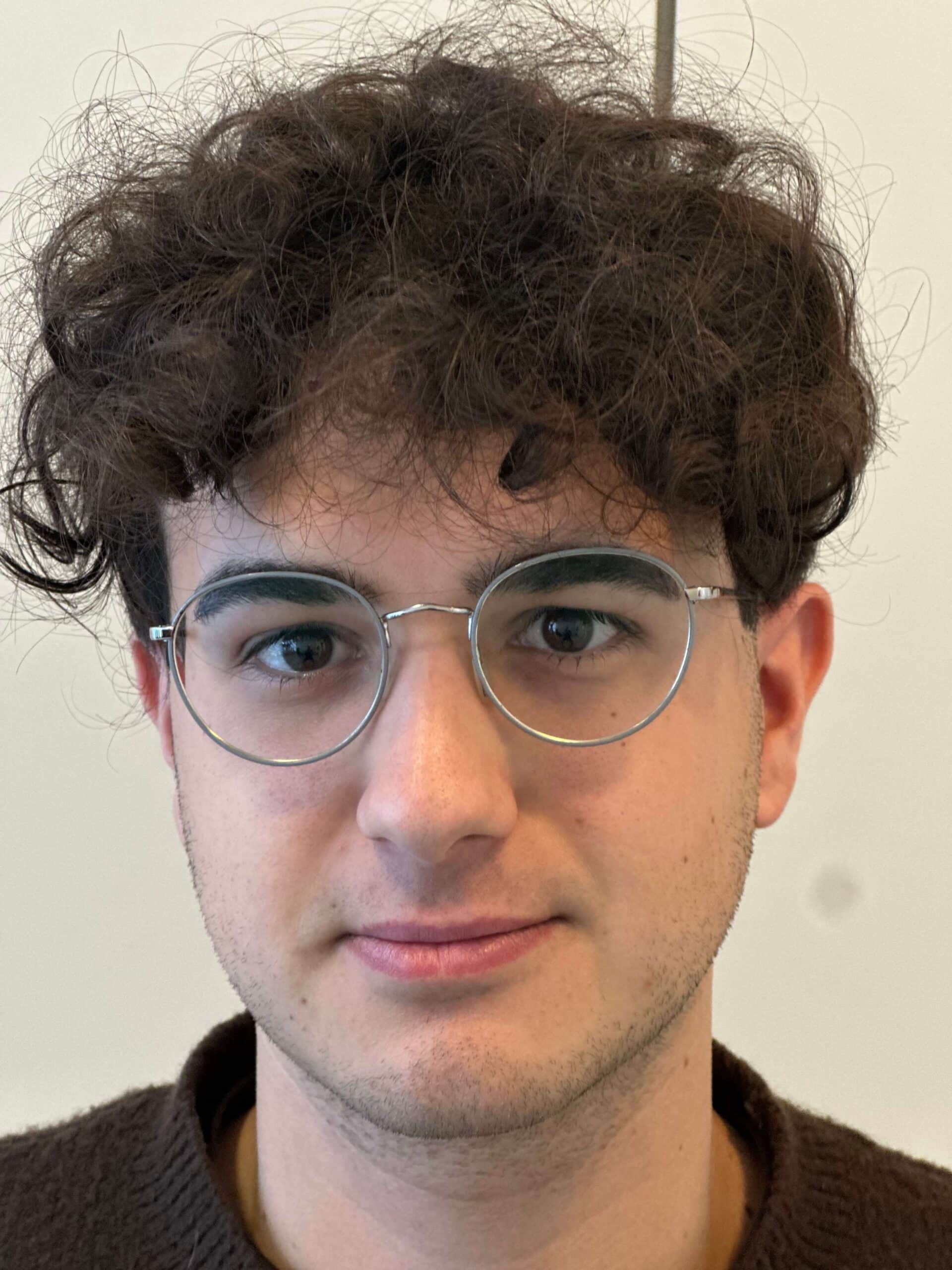 prima relex smile xtra correzione miopia media astigmatismo lieve dr. angelo appiotti scaled