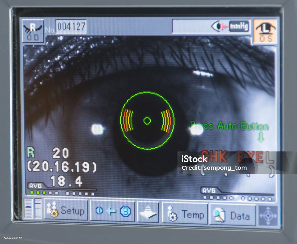 dott angelo appiotti acuita visiva