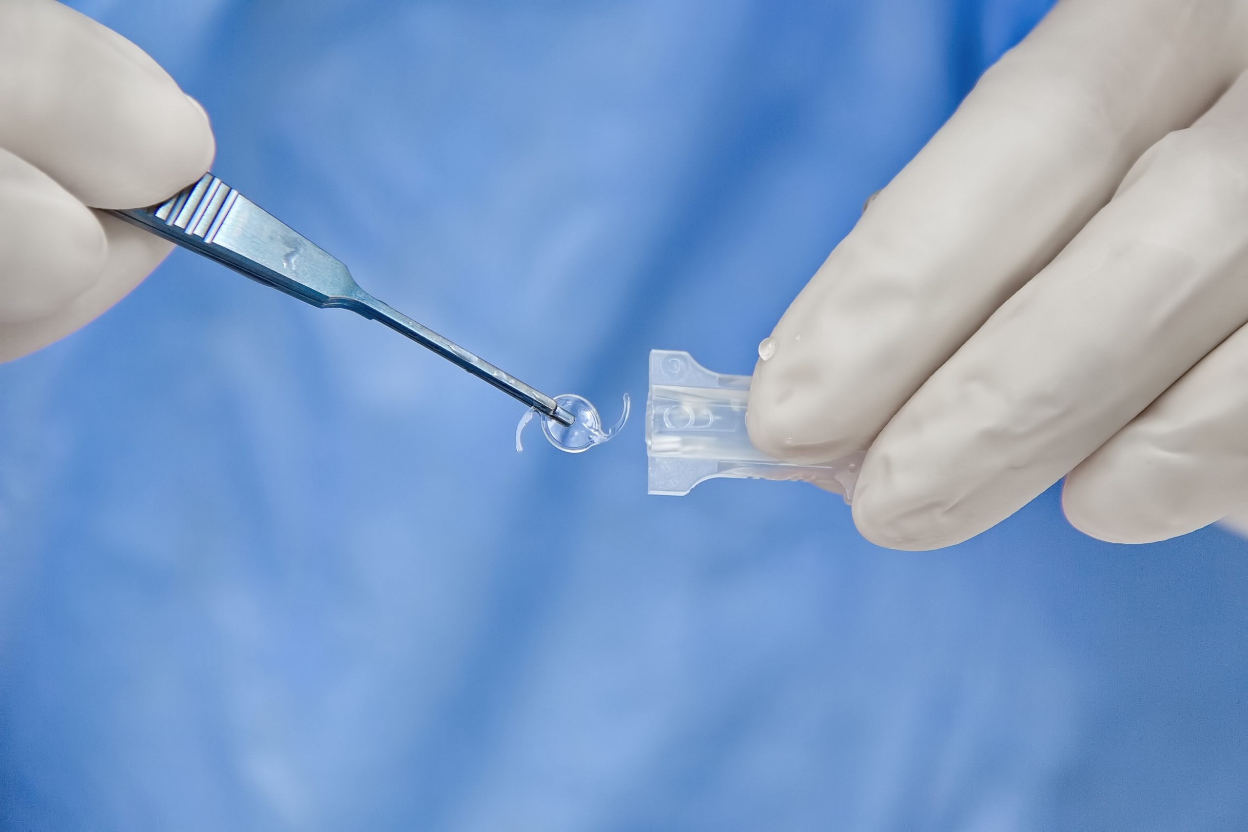 dott angelo appiotti cataratta lenti intraoculari